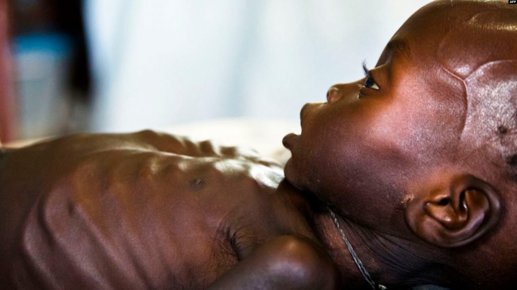 Para Aktivis Desak Pendekatan Baru Malnutrisi Akut Sudan Selatan