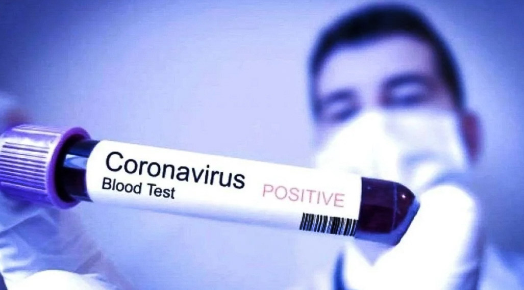 Gegara Virus Corona, Mahasiswa Sultra di China Isolasi Diri Sendiri